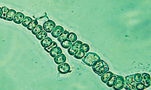 Caractérisation morphologique et moléculaire de <i>Goleter</i> sp. (Nostocales, Nostocaceae) isolée de l’eau douce en Iran
