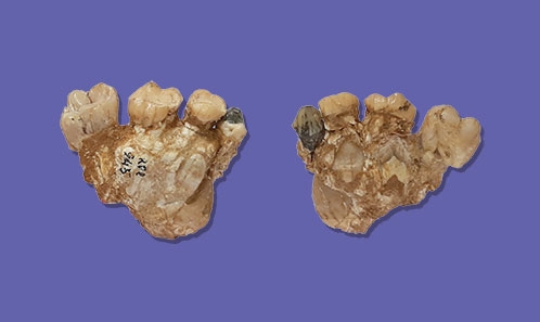 L’hominoïde du Miocène supérieur <i>Ouranopithecus macedoniensis</i> (Bonis, Bouvrain, Geraads & ­Melentis, 1974) : ­dentition déciduale maxillaire et reconstruction virtuelle des dents permanentes non éruptives