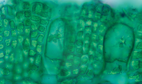 Réévaluation de la diversité du genre d’algues brunes <i>Colpomenia</i> (Endlicher) Derbès & Solier (Scytosiphonaceae, Ectocarpales) en Argentine basée sur le gène mitochondrial <i>cox3</i>, incluant la description de <i>Colpomenia</i> <i>patagonica ...